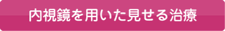 内視鏡を用いた見せる治療